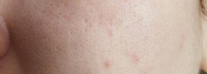 "Корея, а ты умеешь удивлять!" или былина про очищающие средства