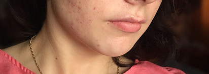 Тканевая маска для лица Esfolio Honey Essence Mask Sheet - медовое наслаждение