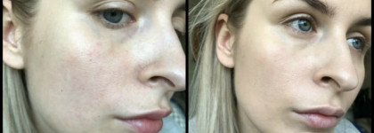 Becca Aqua Luminous Perfecting foundation. Glow must go on