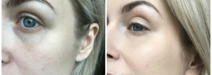 Becca Aqua Luminous Perfecting foundation. Glow must go on