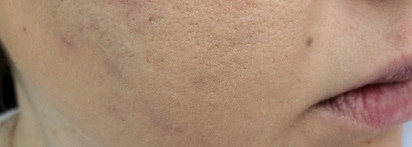 Корректирующий тональный флюид dermablend Vichy Dermablend Fluid Corrective Foundation SPF 35 #15