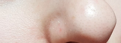 Восстановление кожи после гормонального лечения. Limoni Сыворотка для лица восстанавливающая с экстрактом секреци улитки. Snail Repair Intensive Ampoule