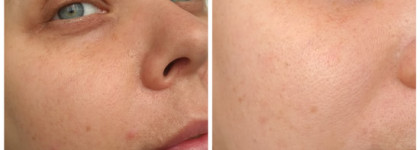 Gigi New Age Facial Scrub кремообразный скраб для деликатного очищения кожи всех типов и Gigi "Retin A" - Triple Power Foaming Cleanser