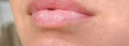 Бальзамы для губ Blistex. История моего знакомства и использования