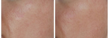 Eucerin Hyaluron-Filler CC Cream Medium