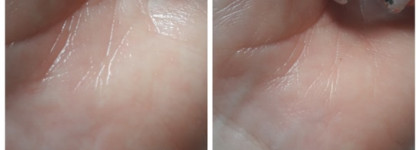 Концентрат против морщин Eucerin Hyaluron-Filler. Верить в чудеса?