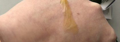 The Ordinary. " B " Oil