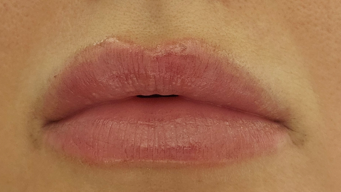 Вот так безобразно ведёт себя блеск Исамайи. Прошло полчаса от нанесения