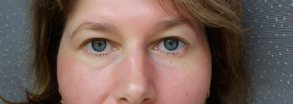 OZ! Organic Zone: Пилинг для лица с AHA-Кислотами с лифтинг-эффектом и гиалуроновая сыворотка для лица