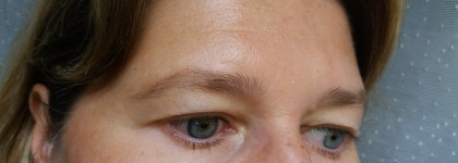 Сыворотка против пигментных пятен Alpha Bright Serum Alphascience