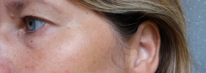 Таниновая сыворотка Tannic Serum (CF) Alphascience против морщин и потери упругости кожи