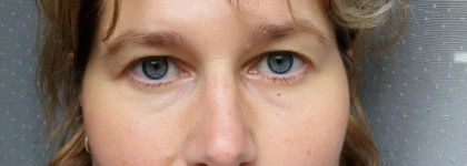 Пилинг-скатка Limoni Amazing Apple Facial Peeling Gel дарит бережное очищение