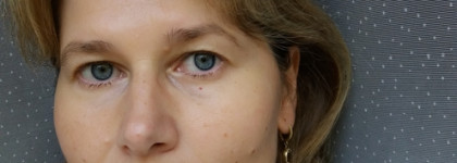 Wrinkle Repair Biome Serum Chicolle - восстанавливающая биом сыворотка с аминомасляной и гиалуроновой кислотой 5D