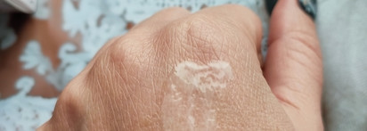 La Roche-Posay Redermic Retinol Eyes Intensive Anti-Wrinkle Resurfacing Hydrating