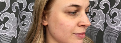 Повесть о том, как линейка средств Clarins White Plus спасла мою проблемную кожу