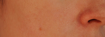 Экстренная помощь коже в холодное время года. Увлажнение и питание. Мой способ