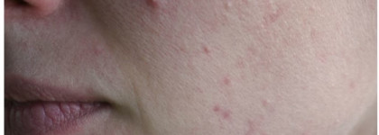 Волшебство крема для лица YOU ARE MAGIC by Allisse со стволовыми клетками мяты