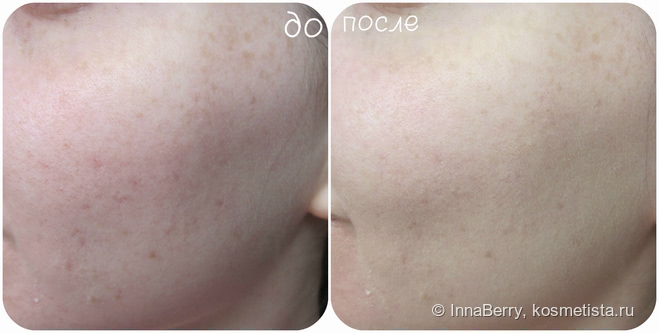 Тональный крем Lumene Matt control oil-free foundation в оттенке #00 был для меня маст хэвом, но после ребрендинга что-то пошло не так. Фото ДО и После