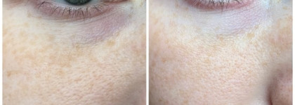 Guam Micro Biocellulaire Crema Contorno Occhi -микробиоклеточный контур-крем для век 