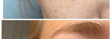 Довольна как слон Estee Lauder Advanced Night Repair Eye Concentrate Matrix