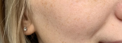 Дорого, но работает - эксфолирующий лосьон Biologique Recherche Lotion P50 1970. 