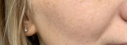 Самое комфортное отшелушивание. Пилинг-скатка Holika Holika Smoothie Peeling Gel