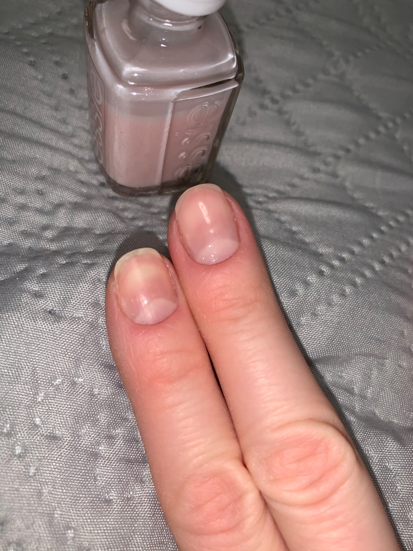 Указательный палец без покрытия, на среднем так Essie в 1 слой ( вспышка камеры)