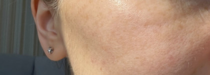 Ухода много не бывает - сыворотка для сияния кожи с витамином С от бренда Skinjestique