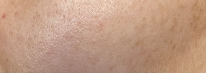 Skinjestique Antioxidant Vitamin Serum