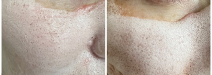 Новый отшелушивающий фаворит Payot bubble mask peeling