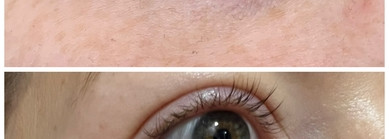 Ретинол+пептиды для зоны век