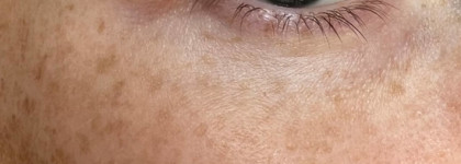 Пептиды для век: крем-сыворотка Гельтек Home Care