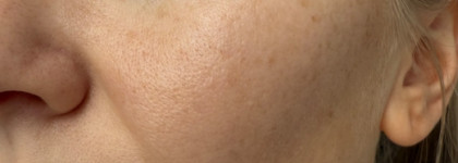 Замечательный зимний крем-лифтинг Filorga Nutri-Filler