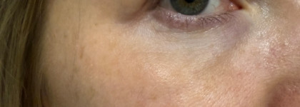 Интенсивная омолаживающая сыворотка Regenique — отлично, но мало