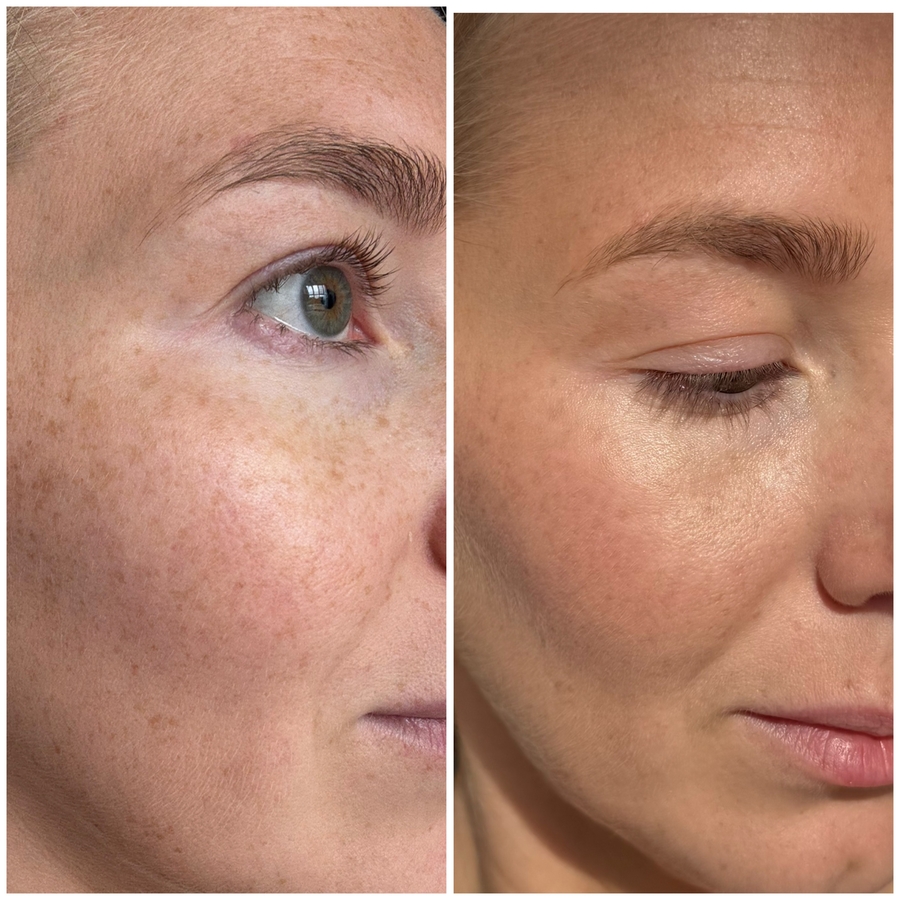 Как раз делала фото для отзыва о новом тоне и состояние кожи очень порадовало