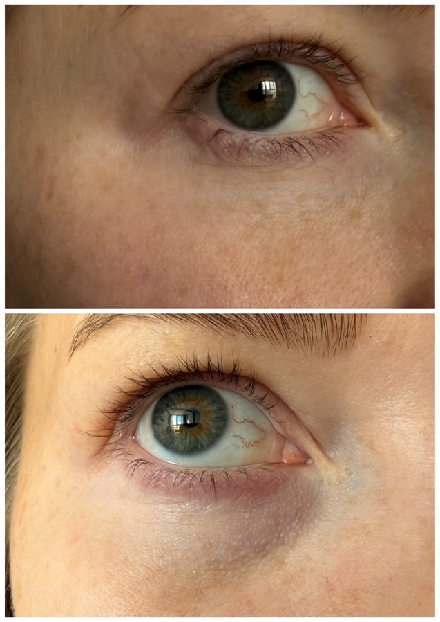 Разница между фото примерно 1-1,5 месяца