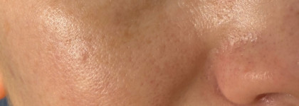 Приятно удивившая меня сыворотка Don’t touch my skin Azacid