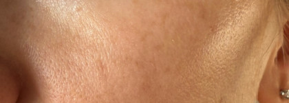 Приятно удивившая меня сыворотка Don’t touch my skin Azacid