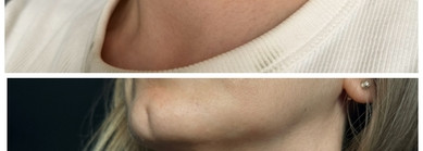 Крем для области шеи декольте Guam Crema Collo e Décolleté