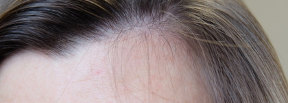 Обязательный этап ухода - Отшелушивающая сыворотка-пилинг для кожи головы Openface Such A Big Peel