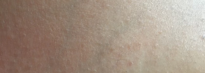 Два средства от вросших волос от Noreva и Skin Doctors