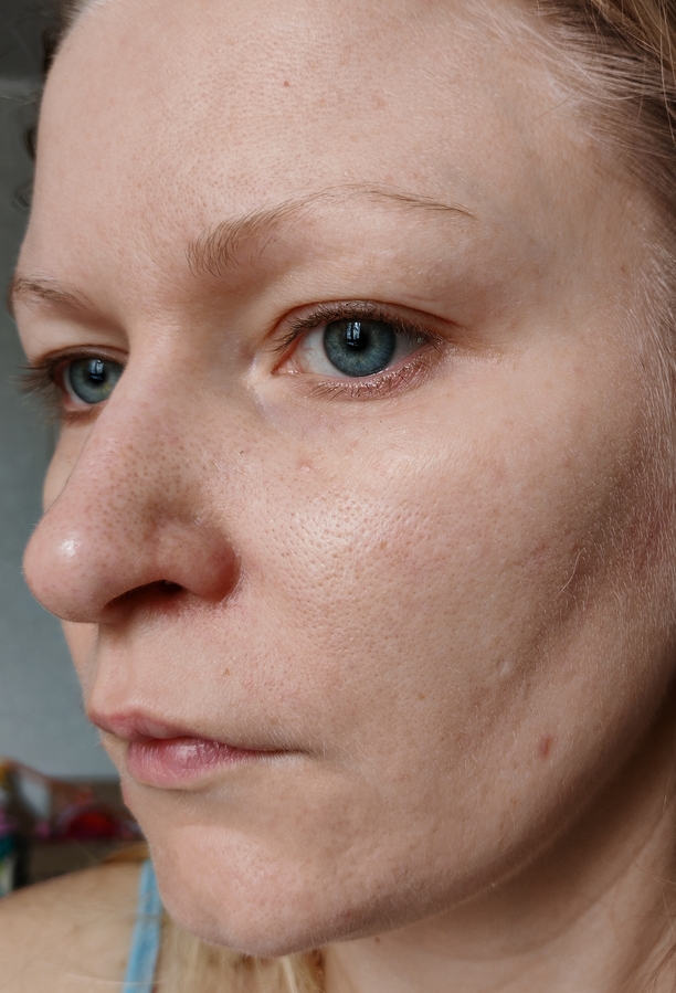 После использования маски