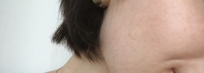 Срочно в номер: лучшие vs худшие патчи от прыщей