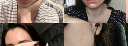 Holy grail: культовый Pixi Glow Tonic при акне и неровном тоне лица + фото до/после