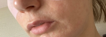 Любимые продукты с кислотами Brightening AHA Peel Mask Madara, Organic Seeds Peeling Finger Mitt Pore Care Whamisa