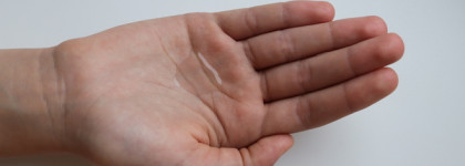 Мой La Roche-Posay. История применения на коже с возрастным акне