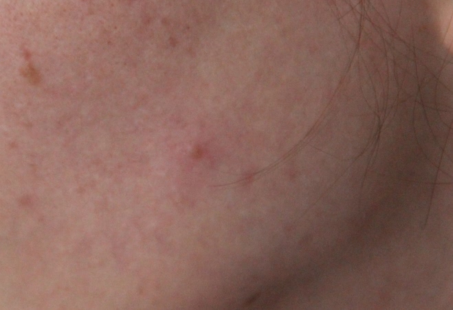 Мои бьюти-находки от Clinique: крем-гель Аnti-Blemish Solutions Clinical, интенсивно увлажняющий гель Moisture Surge 72-Houre и сильнодействующие жидкое мыло для жирной кожи Liquid Facial Soap