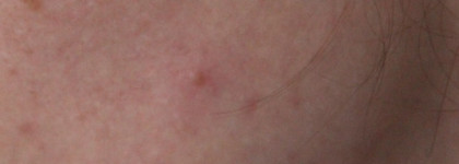 Мои бьюти-находки от Clinique: крем-гель Аnti-Blemish Solutions Clinical, интенсивно увлажняющий гель Moisture Surge 72-Houre и сильнодействующие жидкое мыло для жирной кожи Liquid Facial Soap