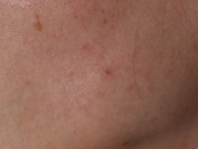Мои бьюти-находки от Clinique: крем-гель Аnti-Blemish Solutions Clinical, интенсивно увлажняющий гель Moisture Surge 72-Houre и сильнодействующие жидкое мыло для жирной кожи Liquid Facial Soap