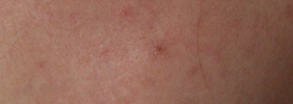 Мои бьюти-находки от Clinique: крем-гель Аnti-Blemish Solutions Clinical, интенсивно увлажняющий гель Moisture Surge 72-Houre и сильнодействующие жидкое мыло для жирной кожи Liquid Facial Soap